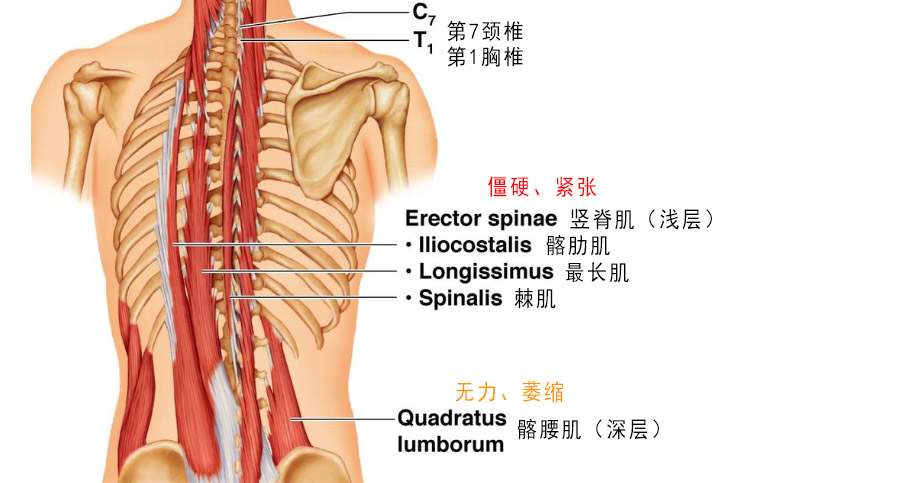躯干无论位于何种姿势,腰背部肌肉都处于收缩状态,以抵抗重力.